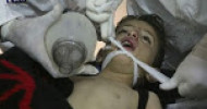 UN awaits full report on chemical attack in Syria IANS