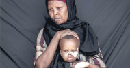 Somalia: A bitter journey of hope for sick children