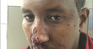 ‘Hate crime’: Taxi driver recounts brutal attack   